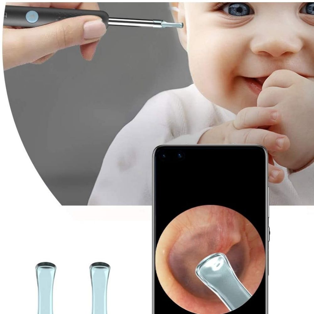 Video Otoscope Ear Cleaner: image 3